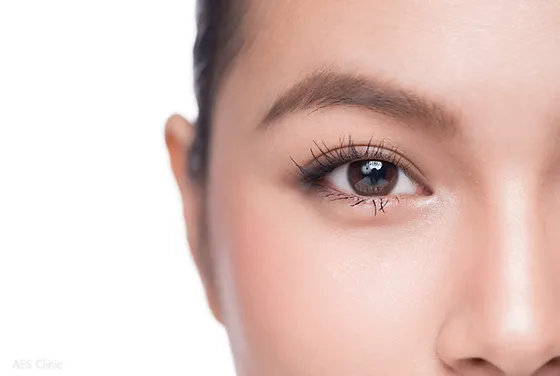 เลขเด็ดฝันว่าทําตาสองชั้น-"Lucky numbers for dreaming about having double eyelids."