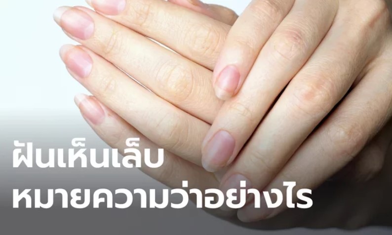 ฝันว่า เล็บหลุด