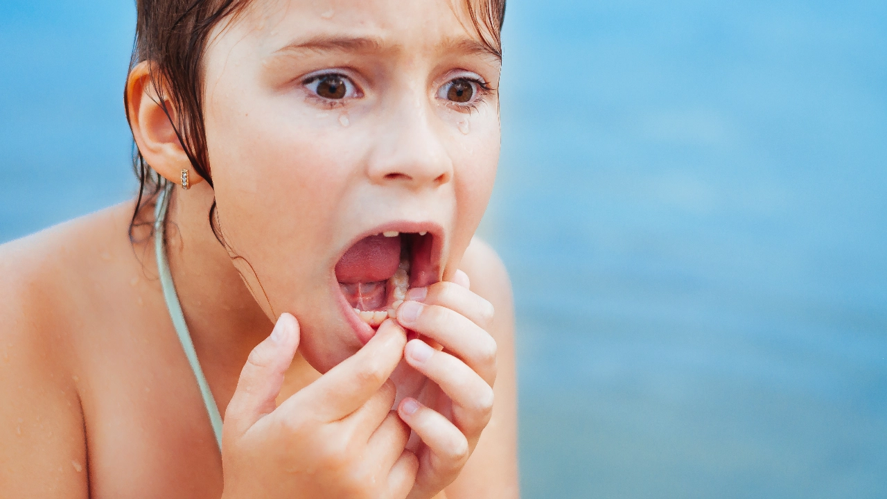 ฝันว่าฟันแตก ทำนายความฝัน