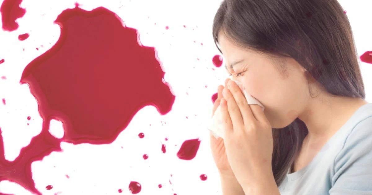 ฝันว่าเลือดออกจมูก-showlek