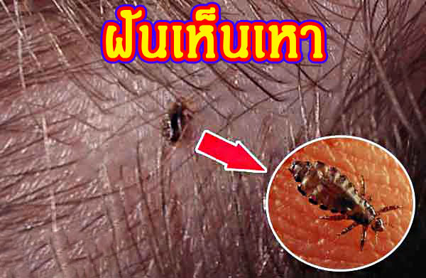 ฝันเห็นเหาบนหัว