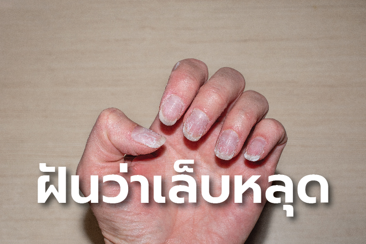 ฝันเห็นเล็บเท้าตัวเอง - "Dream of seeing your own toenails"