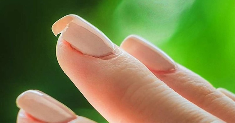 ฝันเห็นเล็บมือคนอื่น - "Dreaming of seeing someone else's fingernails"