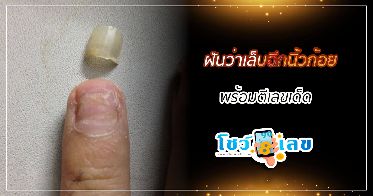 ฝันว่าเล็บฉีกนิ้วก้อย หมายความว่าอะไร มีเกณฑ์ได้โชคหรือไม่ อ่านคำทำนายฝันได้ที่นี่ พร้อมตีเลขเด็ด