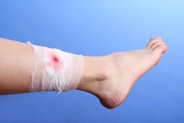 ฝันถูกตัดเท้า - "Dream of having your foot cut off"