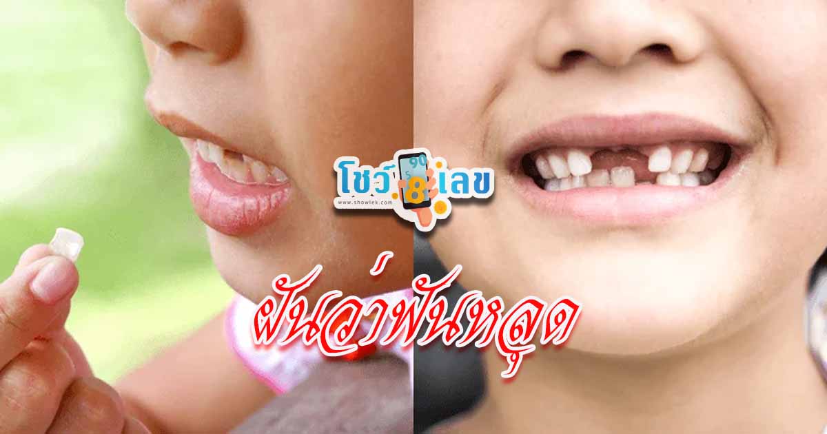 ฝันว่าฟันหลุดเยอะมาก-"Dreamed that a lot of teeth fell out"