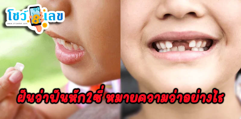 ฝันว่าฟันหัก2ซี่-''Dreamed that 2 teeth were broken''