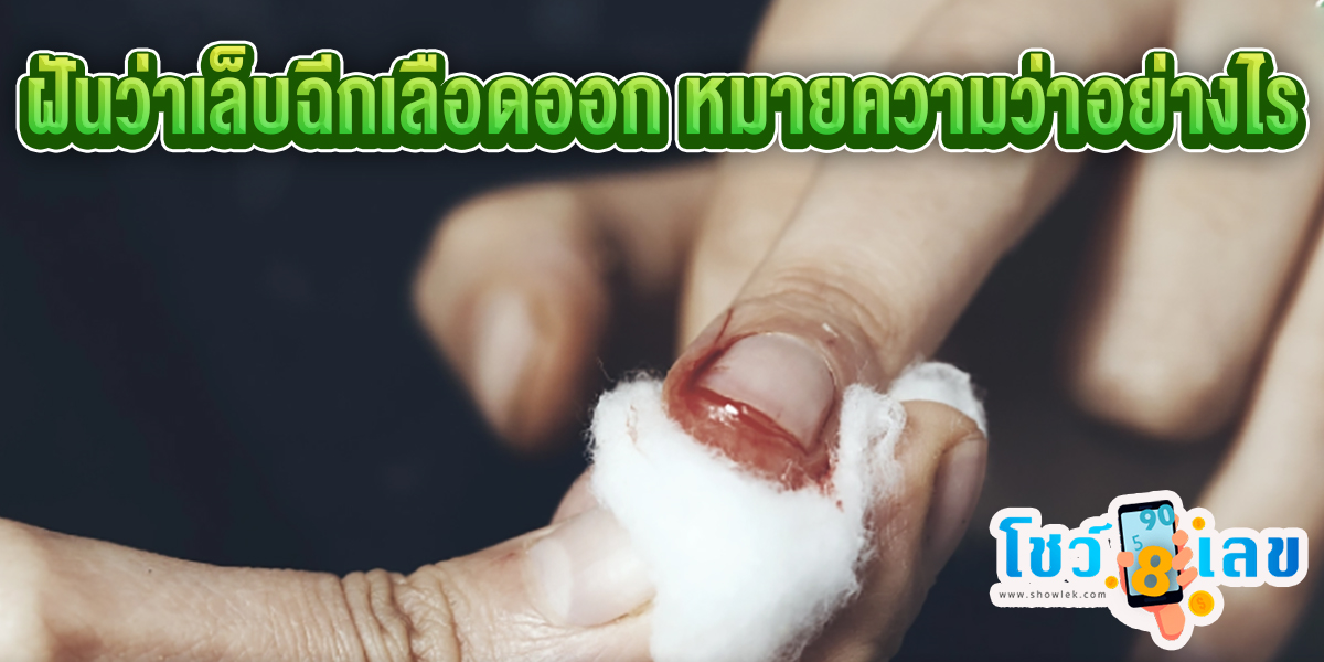 ฝันว่าเล็บฉีกเลือดออก หมายความว่าอย่างไร จะดี หรือ ร้าย หาความหมายพร้อม เลขเด็ดให้โชค เช็กเลยที่ Showlek!!!