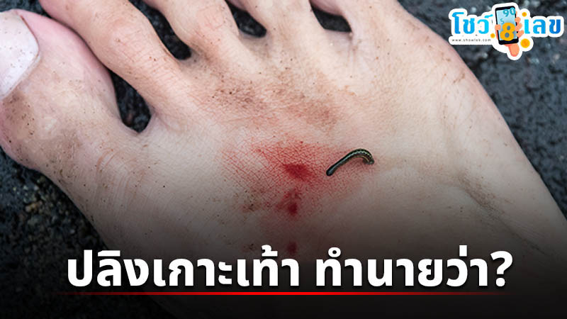 รูปภาพปลิงเกาะเท้าของ lekdedonline