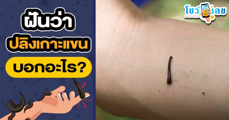 รูปภาพฝันว่าปลิงเกาะแขนบอกอะไรของ heng99